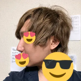 10日目の経過画像（2枚目）