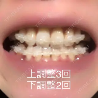 117日目の経過画像（1枚目）