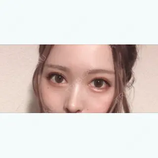123日目の経過画像（1枚目）