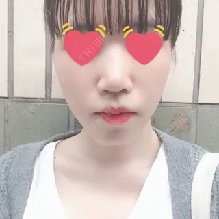 3日目の経過画像（1枚目）