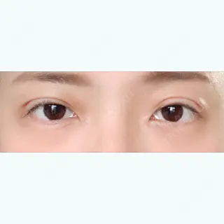 1日目の経過画像（1枚目）