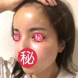 2日目の経過画像（1枚目）