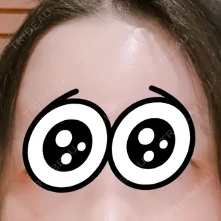 7日目の経過画像（1枚目）