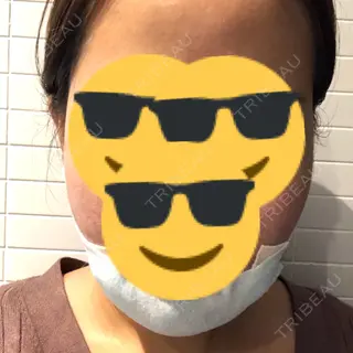 0日目の経過画像（1枚目）