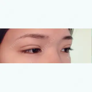 22日目の経過画像（2枚目）