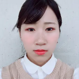 86日目の経過画像（1枚目）