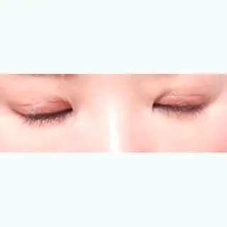 26日目の経過画像（1枚目）