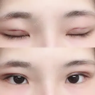 0日目の経過画像（3枚目）