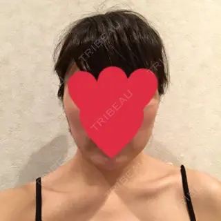 9日目の経過画像（1枚目）