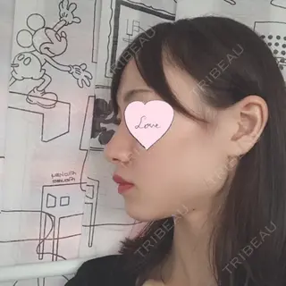 4日目の経過画像（3枚目）