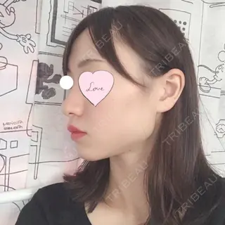 4日目の経過画像（2枚目）