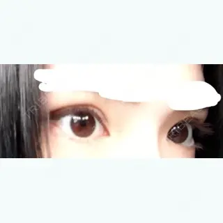 9日目の経過画像（2枚目）