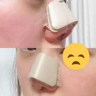 2日目の経過画像（2枚目）