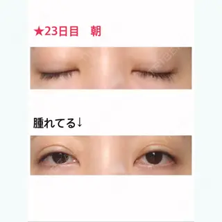 22日目の経過画像（1枚目）