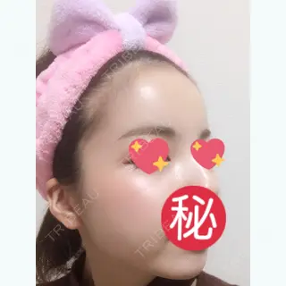 11日目の経過画像（1枚目）