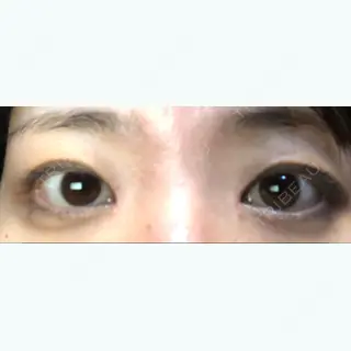 50日目の経過画像（1枚目）