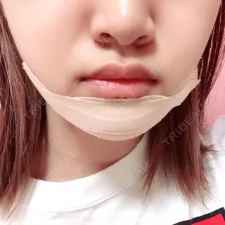 1日目の経過画像（1枚目）