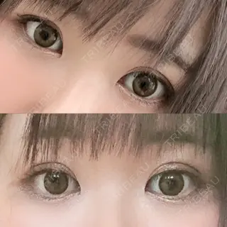 29日目の経過画像（1枚目）