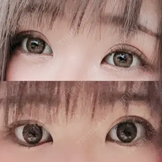 29日目の経過画像（2枚目）