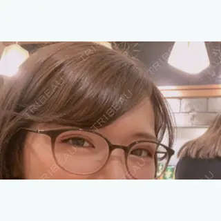 29日目の経過画像（3枚目）