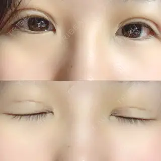 4日目の経過画像（1枚目）