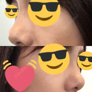 3日目の経過画像（2枚目）