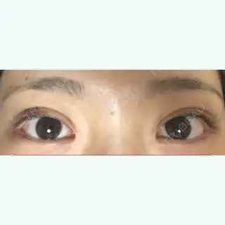 2日目の経過画像（2枚目）