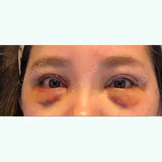 4日目の経過画像（1枚目）