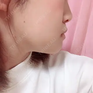 3日目の経過画像（3枚目）