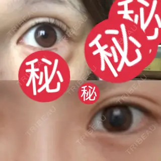 22日目の経過画像（2枚目）