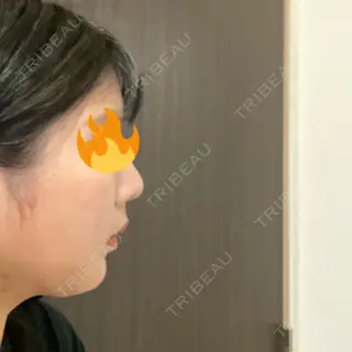 9日目の経過画像（2枚目）