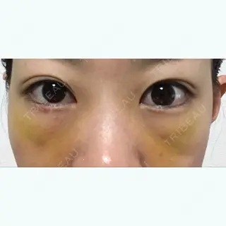 7日目の経過画像（1枚目）