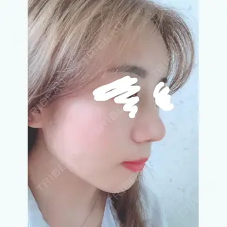 7日目の経過画像（1枚目）