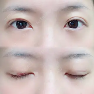 9日目の経過画像（1枚目）