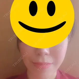 455日目の経過画像（1枚目）