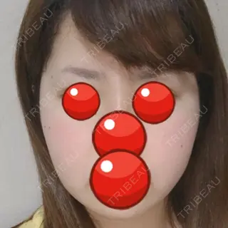 26日目の経過画像（1枚目）