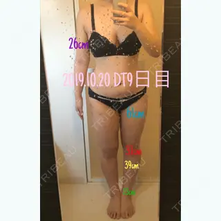 9日目の経過画像（1枚目）