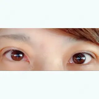 0日目の経過画像（1枚目）