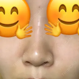 1日目の経過画像（2枚目）