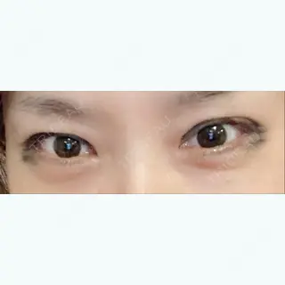 245日目の経過画像（1枚目）