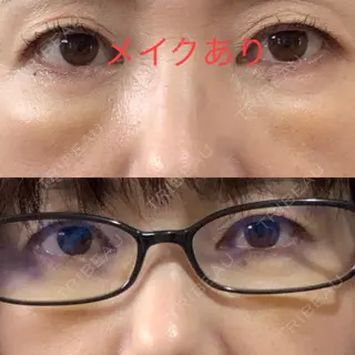 3日目の経過画像（3枚目）