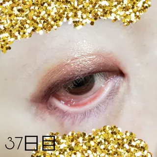 37日目の経過画像（1枚目）