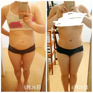 1日目の経過画像（2枚目）