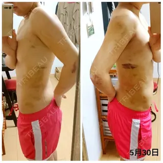 3日目の経過画像（2枚目）