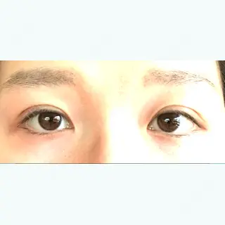 2日目の経過画像（1枚目）