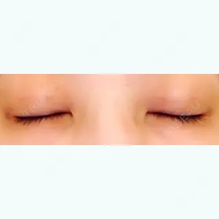 2日目の経過画像（2枚目）
