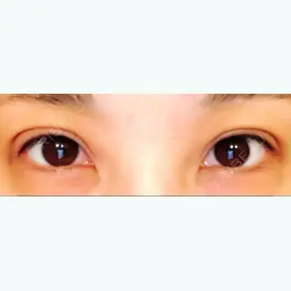 2日目の経過画像（1枚目）
