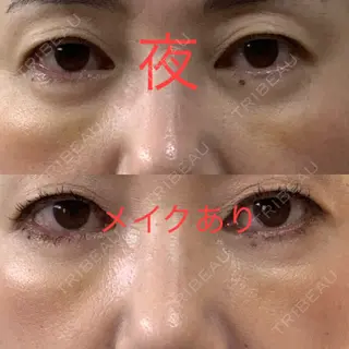6日目の経過画像（1枚目）