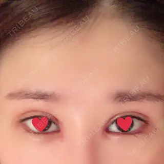 7日目の経過画像（1枚目）