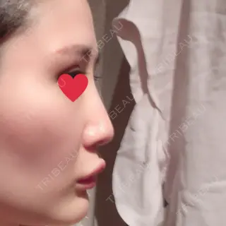 8日目の経過画像（3枚目）